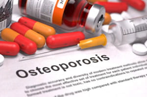 Osteoporosis-drugs
