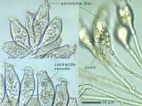 Opercularia-coaractata